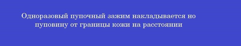 Одноразовый пупочный зажим накладывается но пуповину от границы кожи на расстоянии